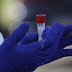 В мире новый рекорд по числу заболевших: какая ситуация с коронавирусом 