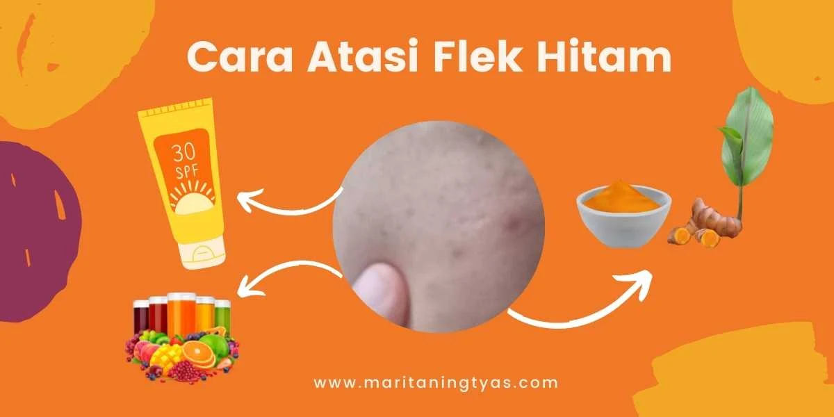 cara mengatasi flek hitam