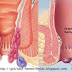 Obat Herbal Benjolan Di Dubur thumbnail