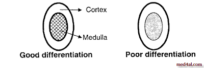 renal-sonar