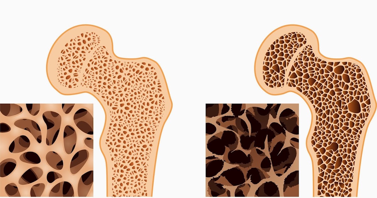GRIT CANGKANG KERANG  Cangkang Kerang  Obati Osteoporosis