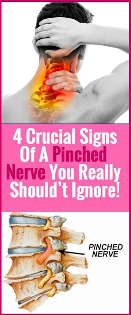 4 Crucial Signs of a Pinched Nerve You Really Should’t Ignore