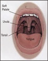 Obat tradisional (herbal) sakit radang tenggorokan (faringitis)