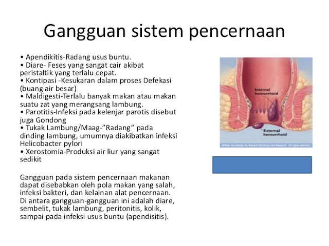 Gangguan pada sistem pencernaan manusia