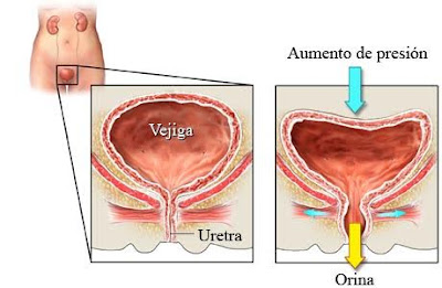 suelopélvico