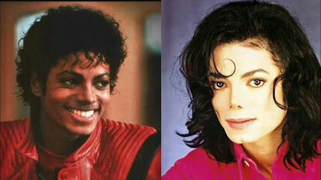 Heartbreaking Testimony: This Is How Michael Jackson's Skin Color Cleared Up