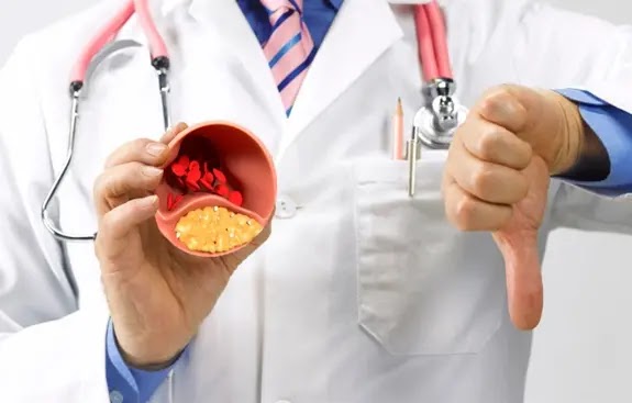 High Cholesterol - Facts You Need To Know High Cholesterol - Facts You Need To Know