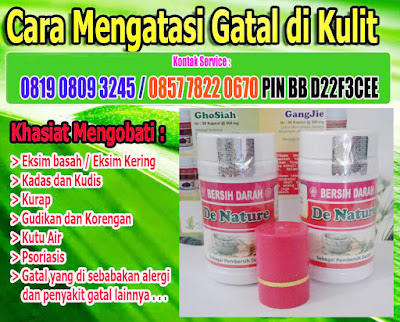 Obat Eksim Gatal Gatal