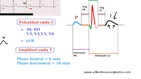 Electrocardiograma y onda T, polaridad y amplitud