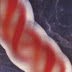 Stem Cells Restore Toddler's Congenital Hearing Loss