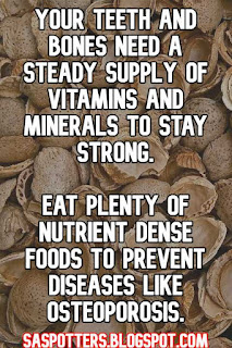 Your teeth and bones need a steady supply of vitamins and minerals to stay strong.  Eat plenty of nutrient dense foods to prevent diseases like osteoporosis.