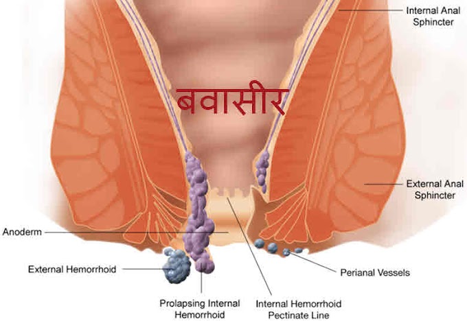 बवासीर से परेशान है तो और इसे जड़ खत्म करना है चाहते है  तो एक बार जरूर पढ़े...