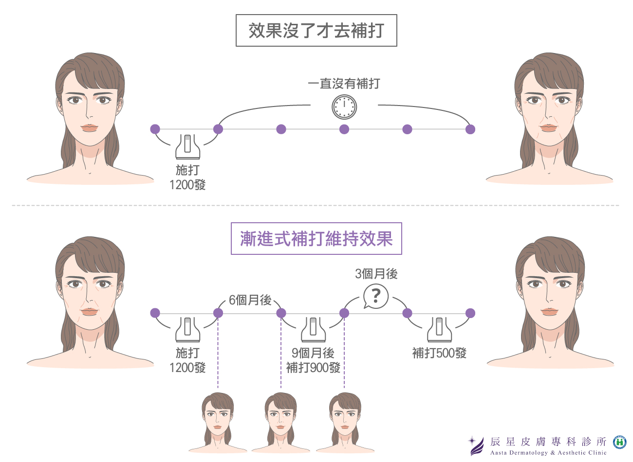 電波拉提施打發數