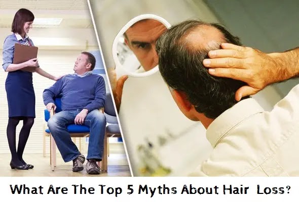 What Are The Top 5 Myths About Hair Loss?