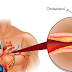 Tips to have cholesterol at bay