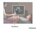 pregnancy ultrasound