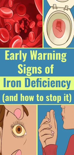 Iron Deficiency Symptoms That You Shouldn’t Ignore