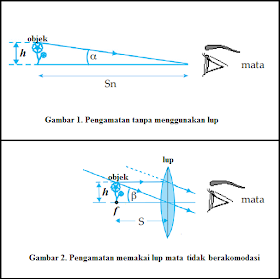 Pembesaran Lup Mata Tidak Berakomodasi