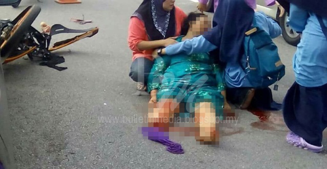 Sayu.. Pengorbanan Seorang Ibu apabila Parah Putus Kaki Di Depan Sekolah Anaknya Sendiri... Tak Sanggup Nak Tengok.. Doakan Ibu Kita Sentiasa Selamat Dan Sihat