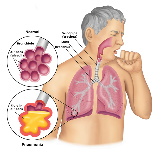 Procedure, Treatment and Therapy: July 2011