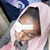 Bride Suffers Injury In Her Eye After Vigilante Members Allegedly Disrupted Her Wedding Party In Kano