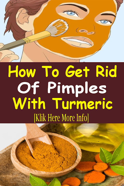 How To Get Rid Of Pimples With Turmeric