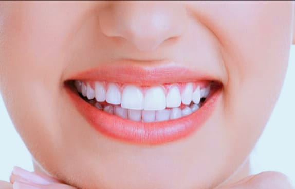 Best Teeth Whitening Methods Naturally