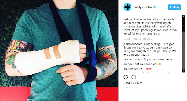 Ed Sheeran breaks arm after crashing off his bicycle in London