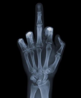 xray pictures