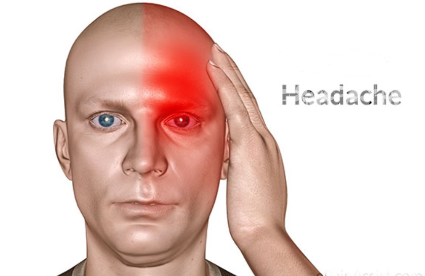 Sakit Kepala Sebelah Kiri Bisa Jadi Tumor Otak Kenali ...