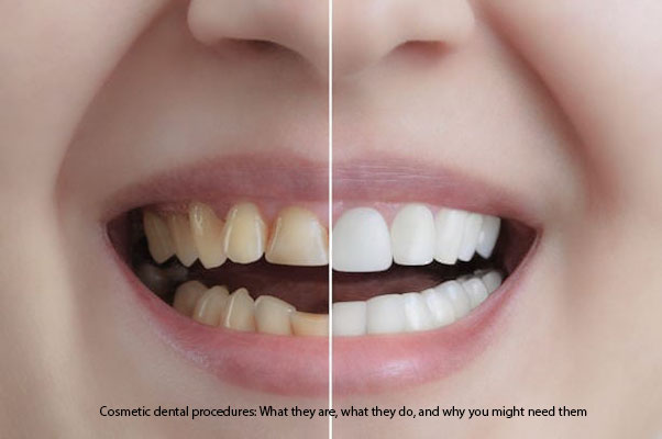 Cosmetic dental procedures: What they are, what they do, and why you might need them