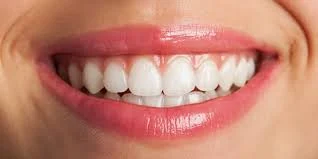 hollywood smile dental clinic dubai