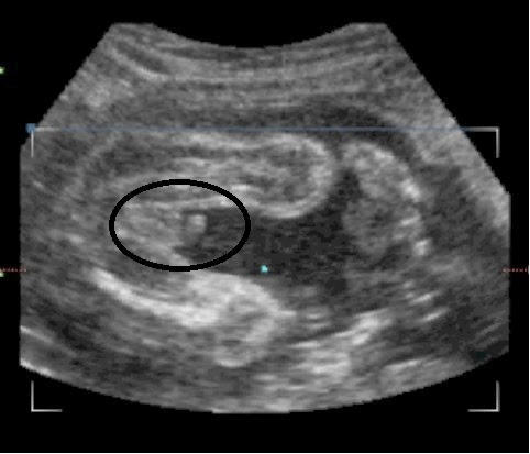  Gambar  Rasa Penasaran Terjawab Setelah Usg  4d Ibuhamil 