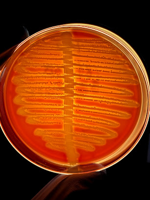 Ágar Sangue com Alfa-hemólise