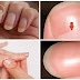 Do You Know What the Half Moon Shape On Your Nails Means – You Will Be Surprised How Important Is This For Your Health