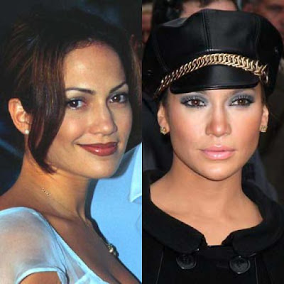 Celebrity Nose Job Before and After