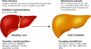 what are causes of NAFLD?