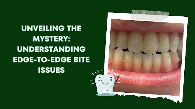 Unveiling the Mystery: Understanding Edge-to-Edge Bite Issues