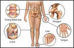 obat tradisional untuk penyakit asam urat dan rematik manjur