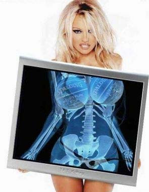 pamela_anderson+(funslol.com).jpg