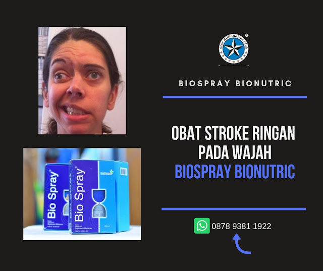 Obat Stroke Ringan Pada Wajah Bio Spray Bionutric