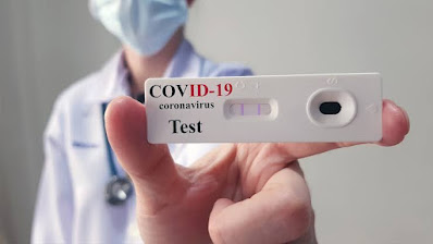 Antigen Test of covid-19