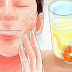 Remove Acne Naturally With Lemon Juice