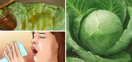 Cabbage Leaves and Honey to Treat Cough and Bronchitis