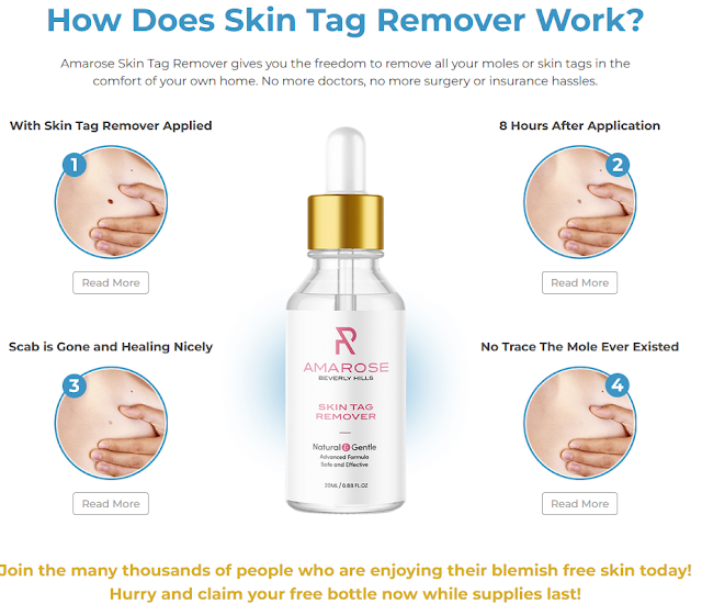 Amarose Skin Tag Remover Working