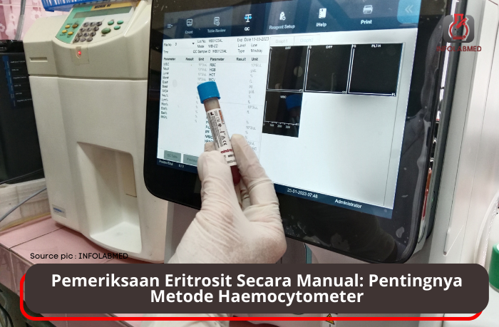 Pemeriksaan Eritrosit Secara Manual Pentingnya Metode Haemocytometer