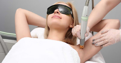 Laser hair removal in Noida