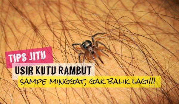 Cara Alami Hilangkan Kutu Rambut dan Telurnya