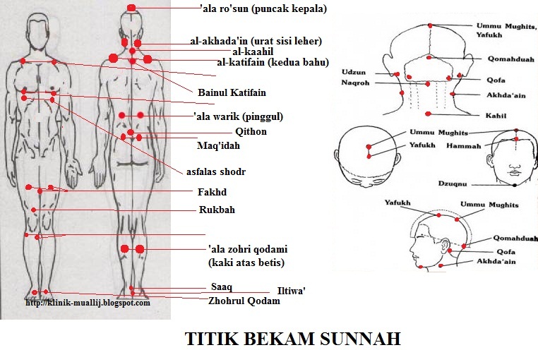 Titik Bekam Titik Bekam Nabi Terapi Titik Bekam  Share The Knownledge