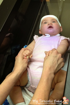 Baby with plagiocephaly and torticollis having her head shape evaluated by a scanner